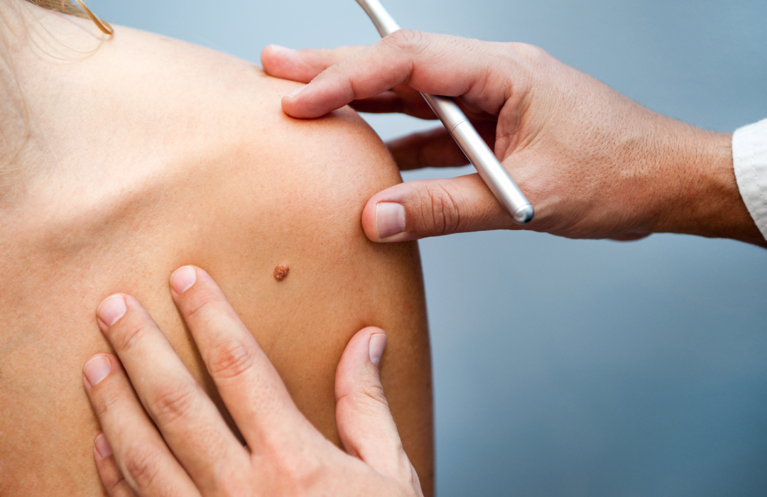 Dermatologist examining a patient’s skin
